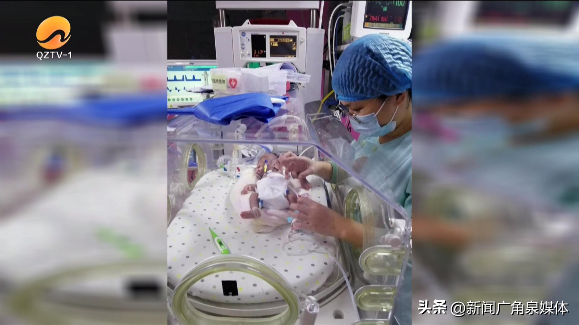 福建省儿童医院心脏介入,泉州儿童医院心外科