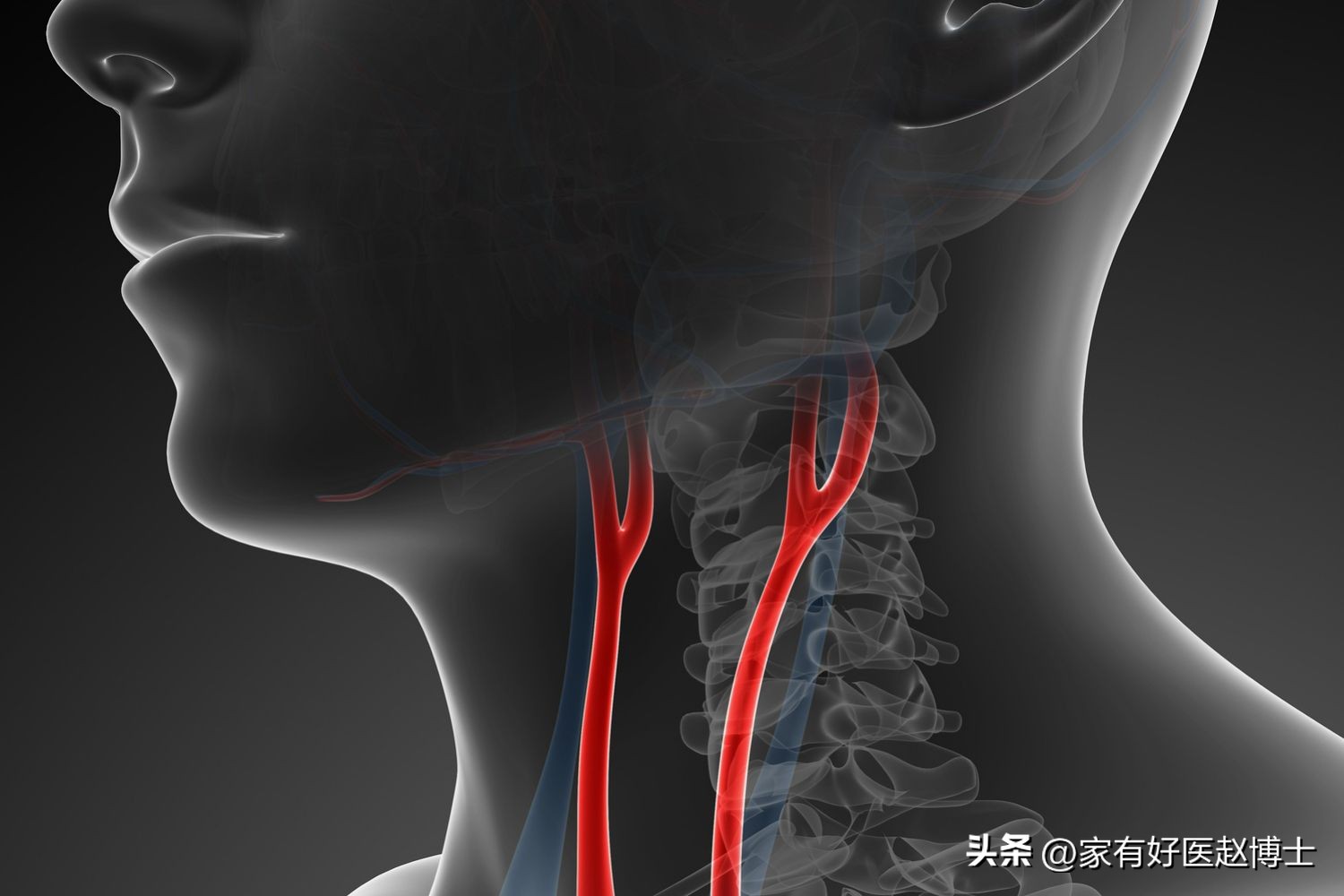 超声颈动脉可以查出什么原因,超声颈动脉斑块的危险评估
