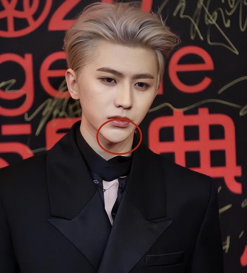 假下巴对决！谁的能戳死人，谁的下一秒就飞出去，谁的越整越残？