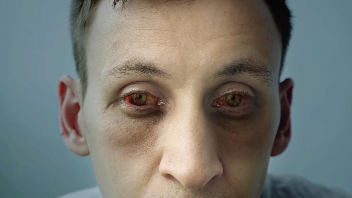 熬夜一时爽一直熬夜身体受不了,熬夜一时爽一直熬夜变秃头