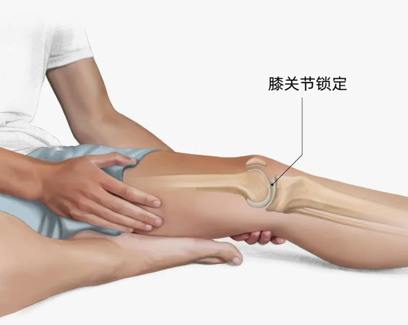 半月板撕裂应该缝合还是切除,半月板撕裂后是切除好还是缝合好