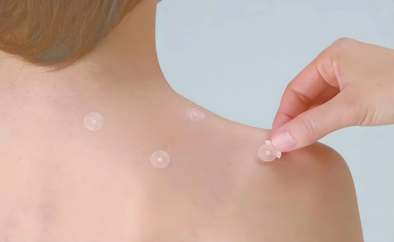 早孕吐的厉害如何缓解,早孕吐的厉害怎么缓解