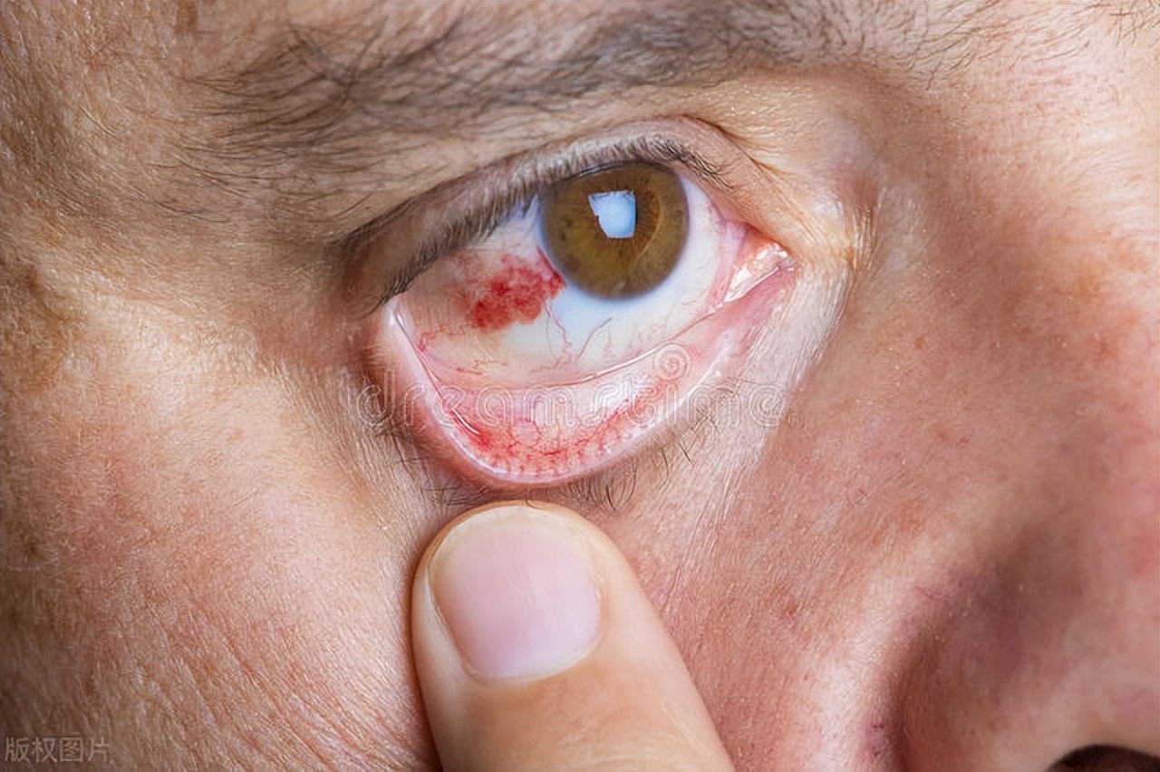 你不知道的眼科医院那些事,你不知道的美睫小知识