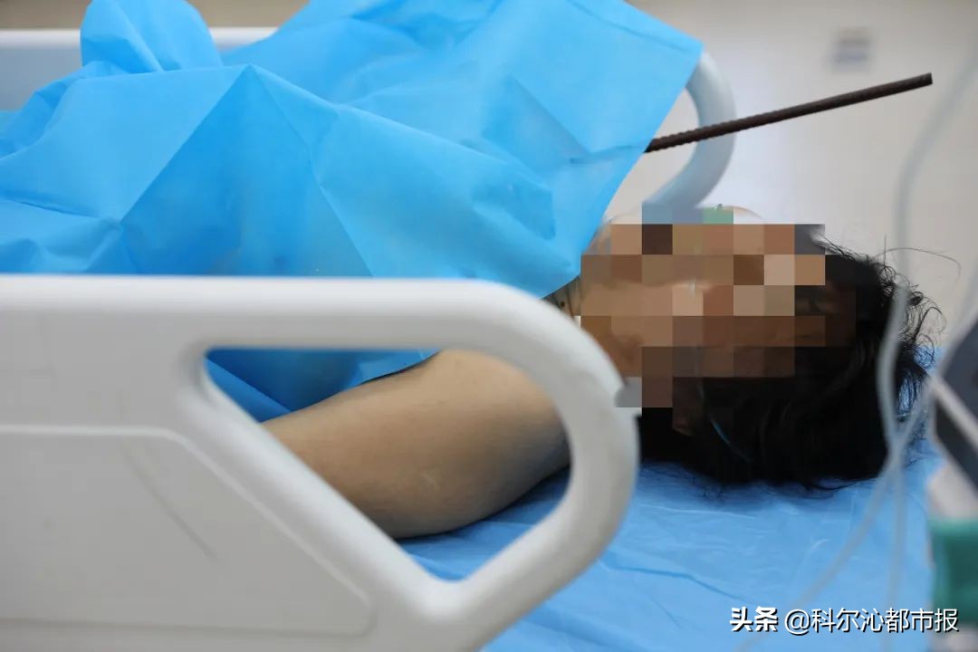 工人身体被钢筋贯穿术后奇迹生还,工人坠落被钢筋贯穿全身奇迹生还