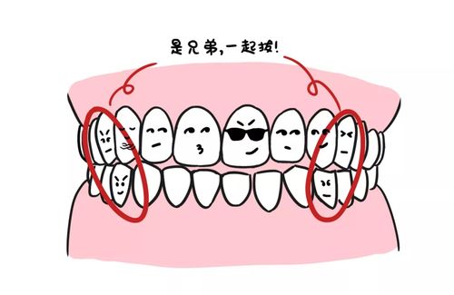 牙齿正畸矫正一般需要多久,正畸科普牙齿矫正的年龄限制问题