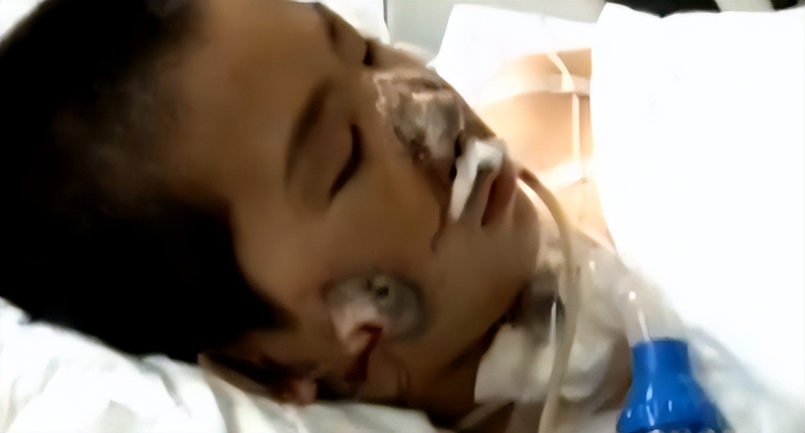 山东13岁男孩体内被打入高压气体,山东男孩被充气后续