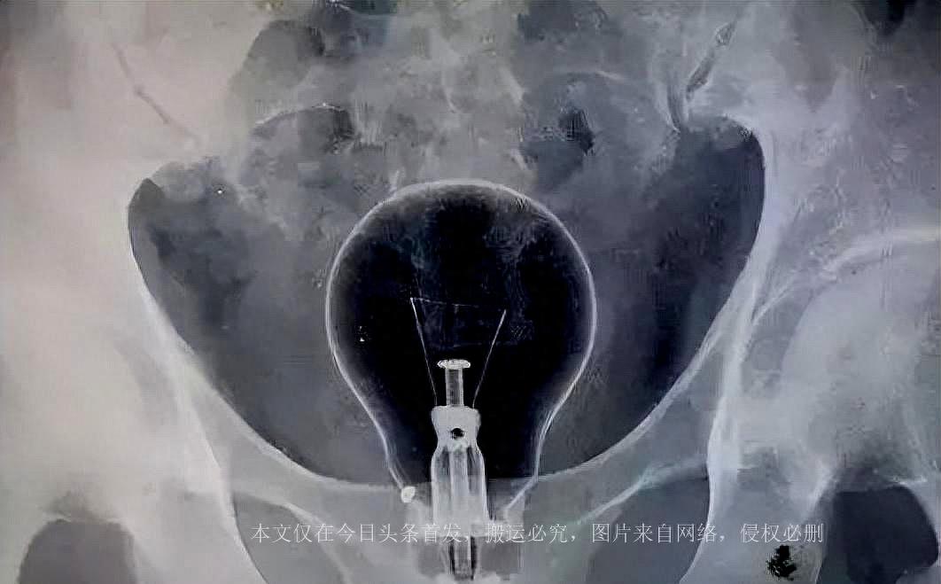 女孩把50cm“仙女管”塞入体内，太令人匪夷所思