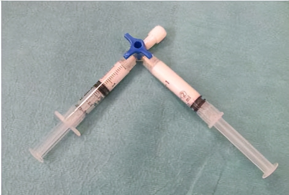 消痔灵内痔注射术操作视频,消痔灵四步注射法视频