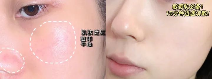 2021美白淡斑面膜十大排行榜口碑,美白祛斑补水保湿面膜测评