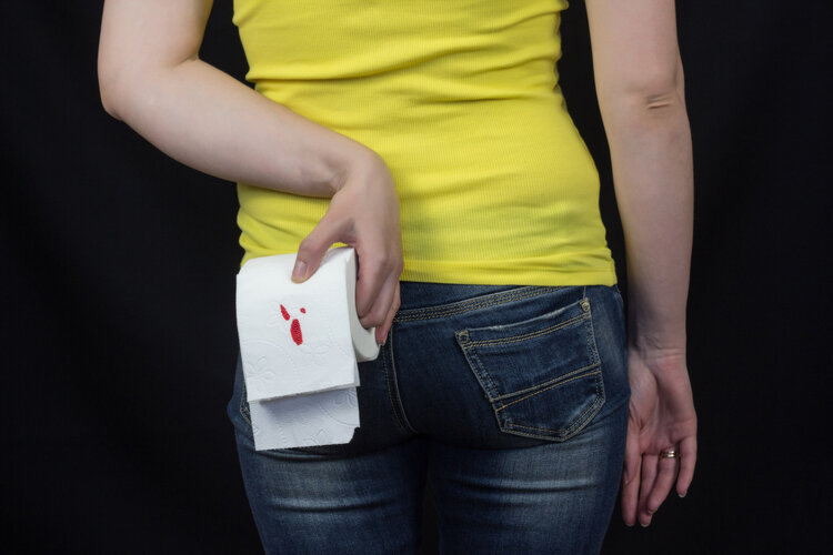 痔疮造成的贫血可以自愈吗,痔疮大出血引起缺铁性贫血怎么医