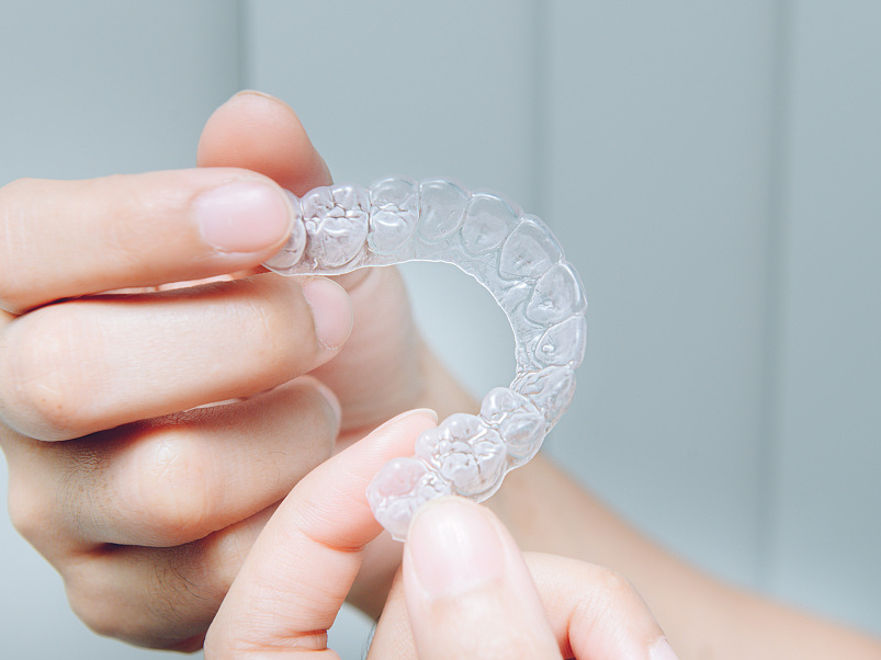 Artsmile小科普｜关于保持器的那些事儿你了解多少？