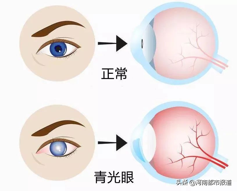 关灯看手机有多危险,该如何解决夜晚关灯看手机