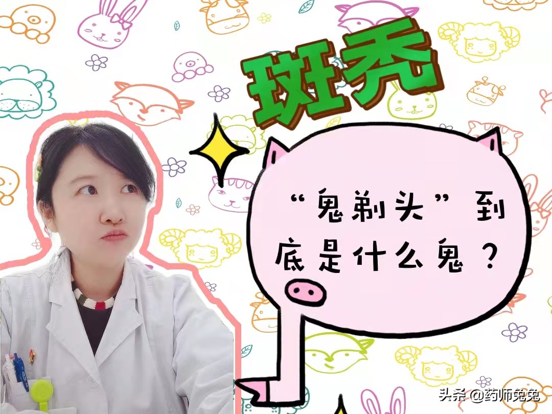 斑秃为什么叫鬼剃头啊,斑秃又被称作为鬼剃头