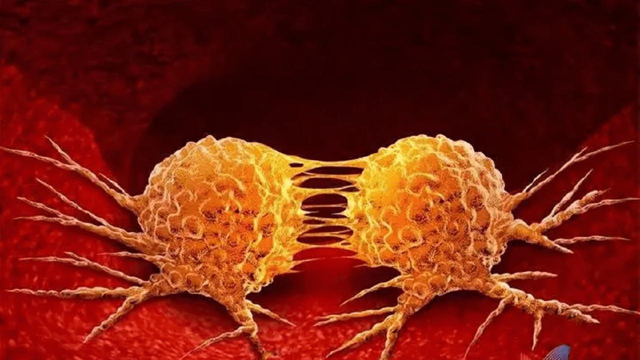 全身都感染了hpv病毒怎么办,身体内发现了hpv病毒感染怎么办