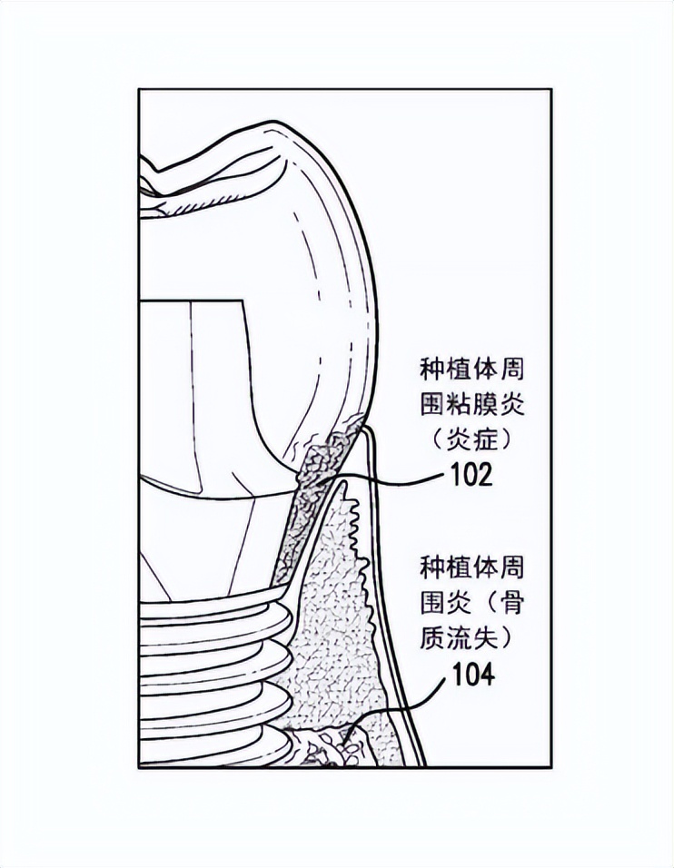 口腔医疗器械行业新闻,玉汝成口腔材料有限公司