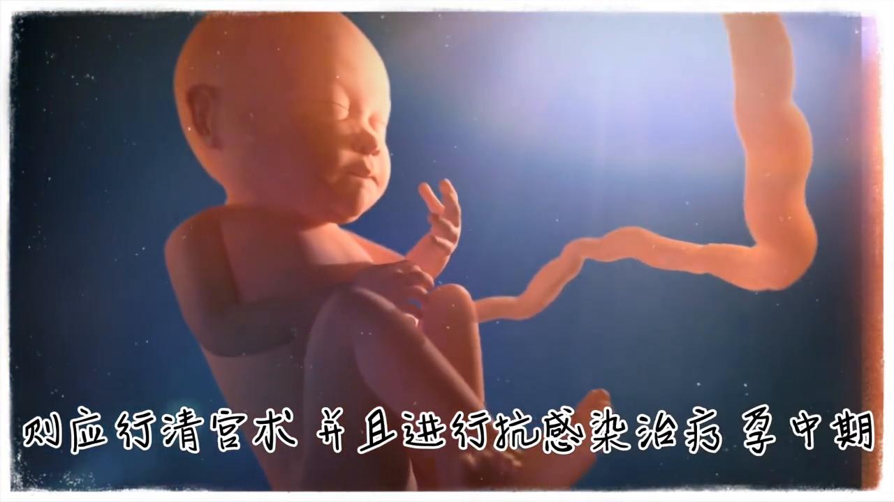 孕期出血怎么办#育儿经验分享