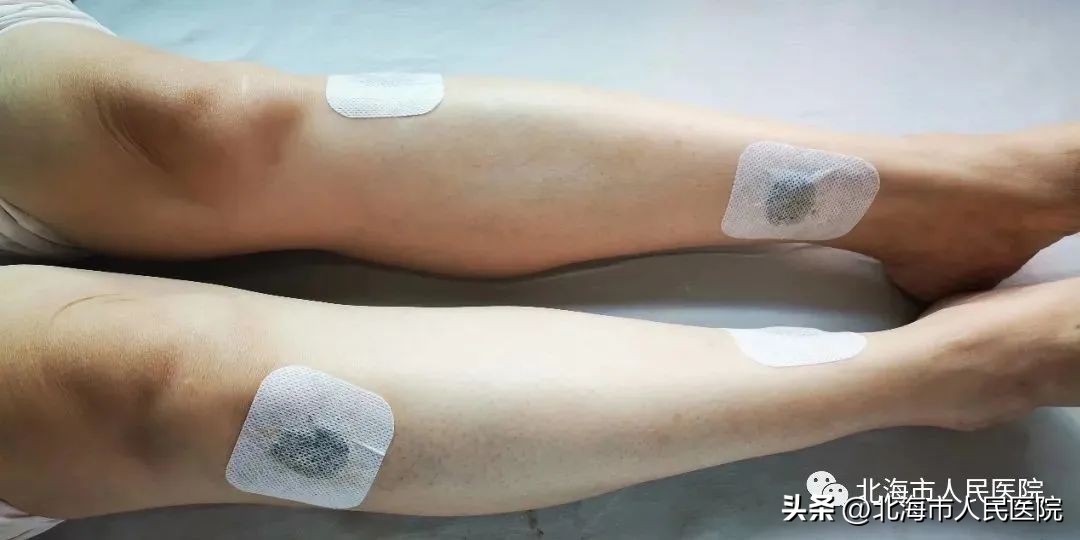 北海人民医院4月份门诊安排,北海市人民医院药膳