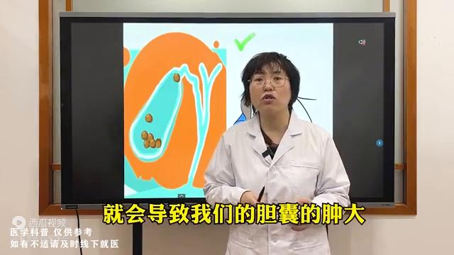 胆结石睡觉姿势朝哪边睡比较好,胆结石人睡觉往左侧还是往右