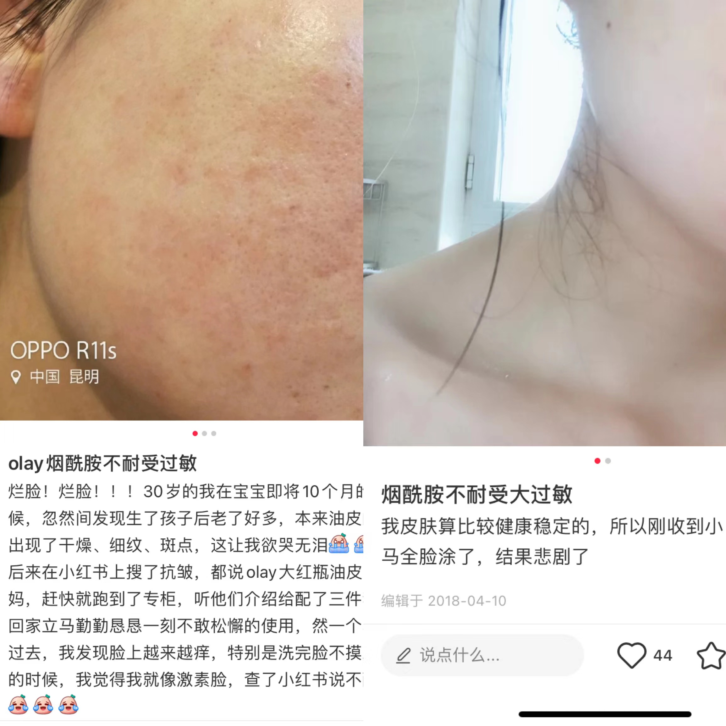 皮肤较油面霜老牌国货,肤色暗沉发黄用面霜有用吗