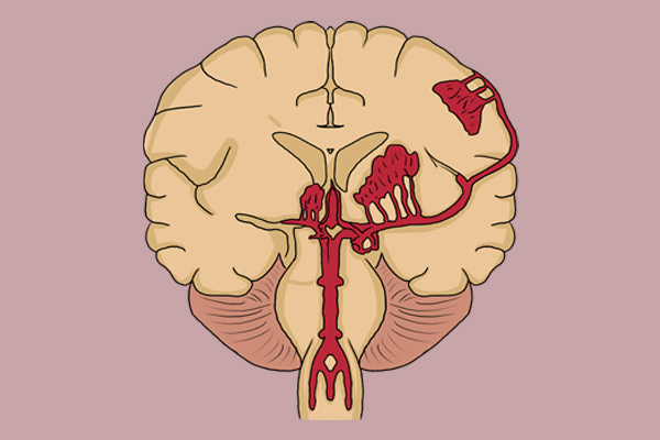 太晚洗头会有湿气吗,洗头早洗伤阳气晚洗生湿气