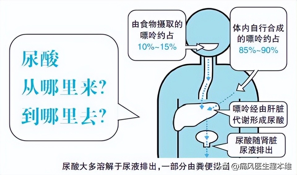 尿酸高最怕三种水,尿酸高这四种水别喝