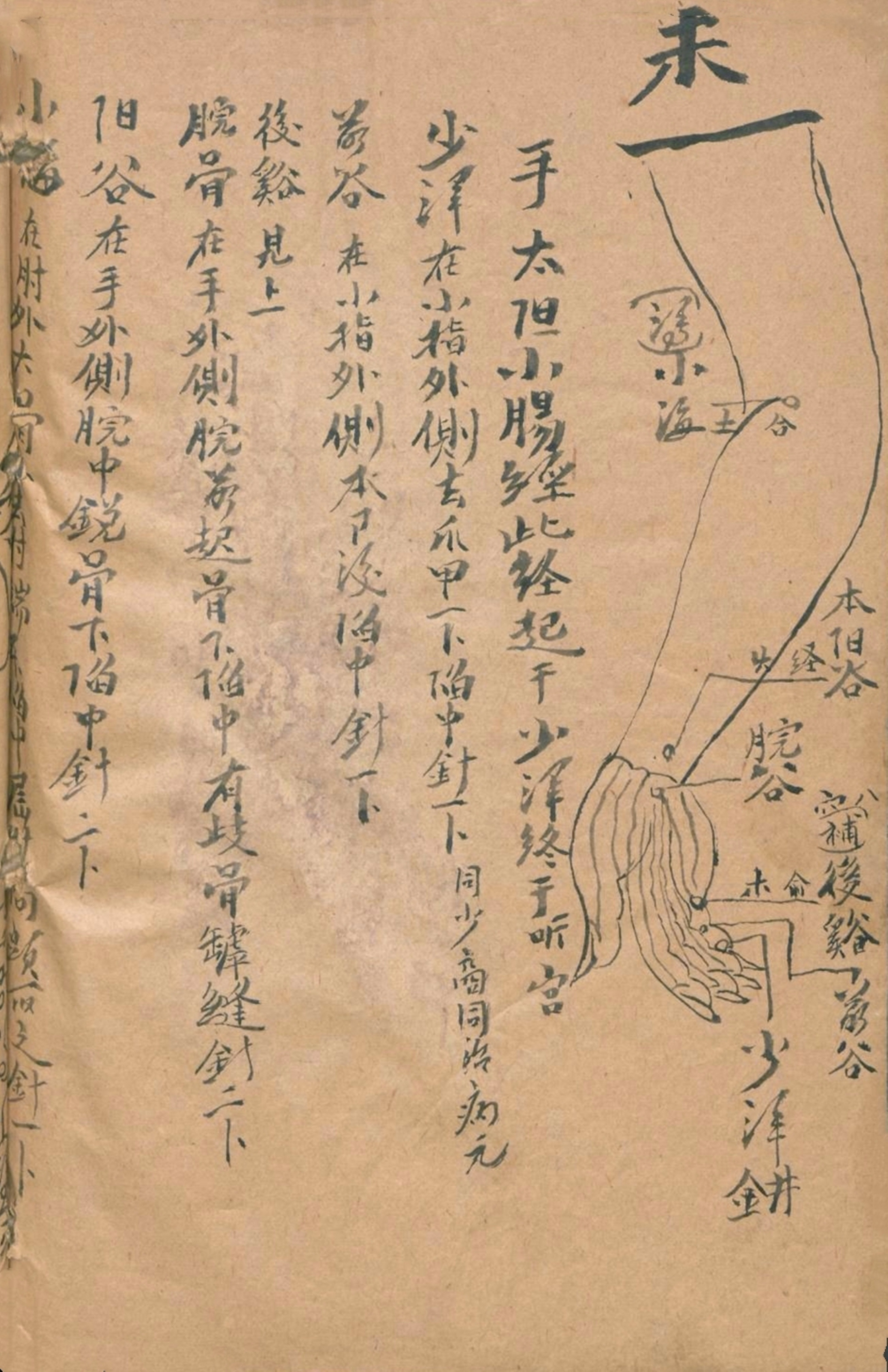 放痧疗法视频,放痧的最佳方法