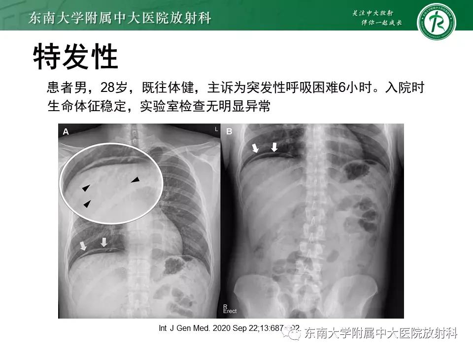 门静脉积气什么意思,好文分享深度揭秘
