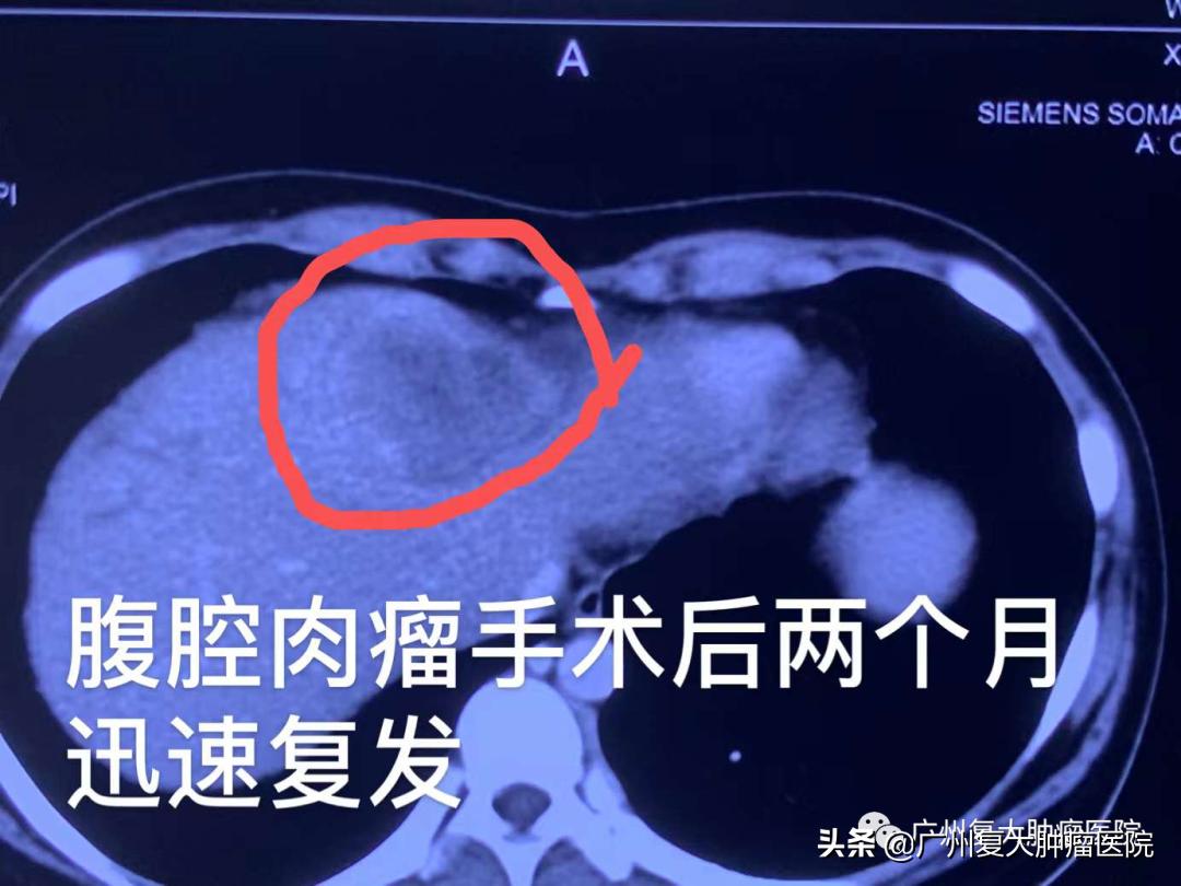 护士节特殊的礼物——来自病区13岁患者创作的手抄报