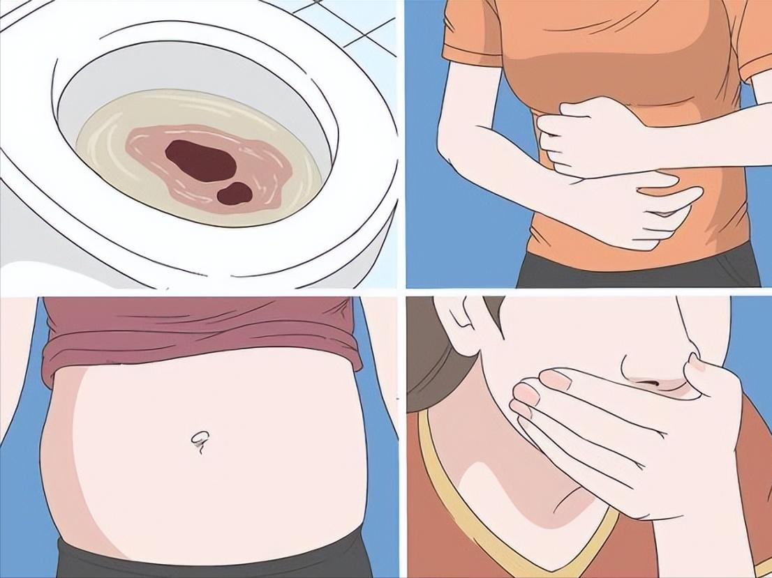 乳果糖是治疗便秘还是缓解便秘,便秘患者能长期吃麻油缓解便秘吗