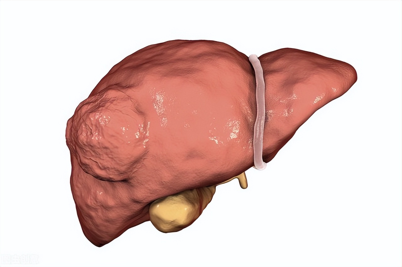 肝癌吃靶向药多久复查,肝癌吃靶向药期间多久复查