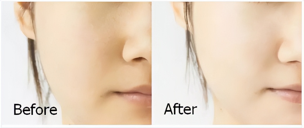 花漾缘面膜,花漾缘祛痘清洁面膜