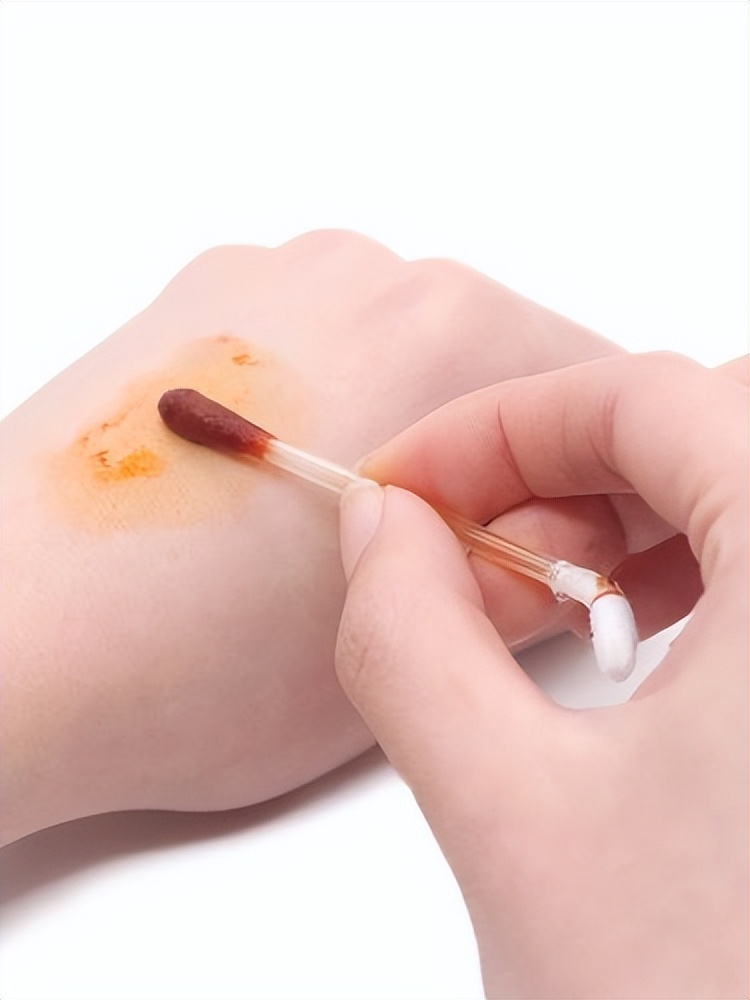 脖子和腋下总长“小肉粒”？可以用手揪吗？医生：与7种疾病有关