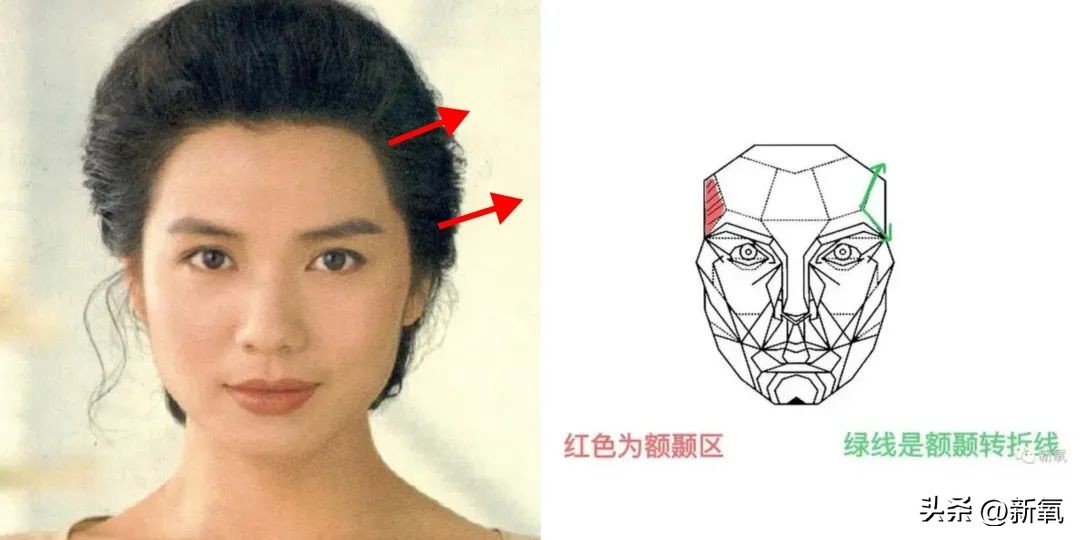 高颅顶怎么掩饰发际线,高颅顶会显得发际线低吗