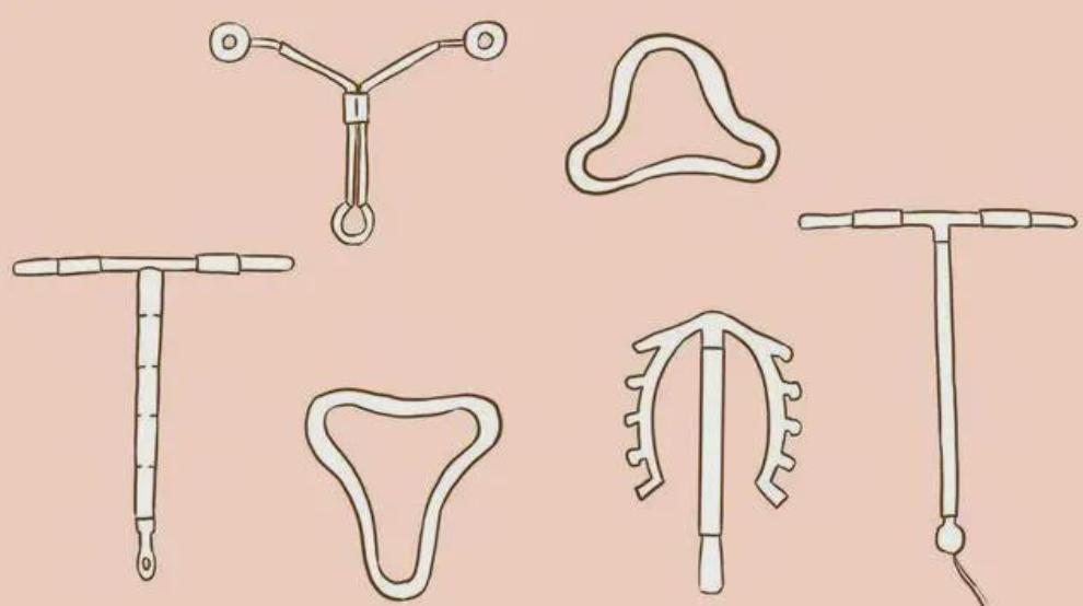 女性年龄大了节育环一定要取掉吗,女性节育环长时间不取的危害