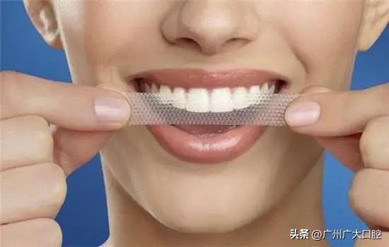 牙齿美白最好的方法又省钱,牙齿美白的4种方法亲测有效