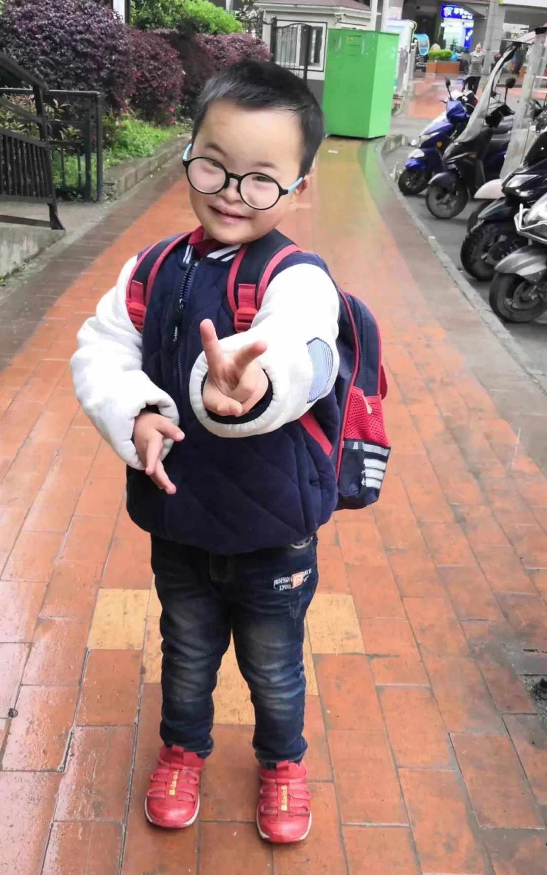 唐氏综合征10岁的孩子,唐氏孩子上小学