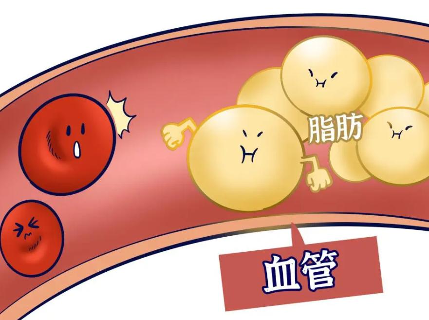 儿童骨密度检测中bmi正常范围,34岁骨密度检测说骨质疏松怎么办