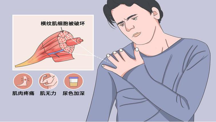 常吃阿司匹林需要做抗凝检查吗,常吃阿司匹林和他汀