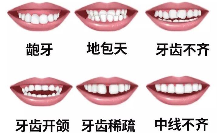 张嘴发出咔咔咔的声音,张嘴腮帮子咔哒响还疼怎么治