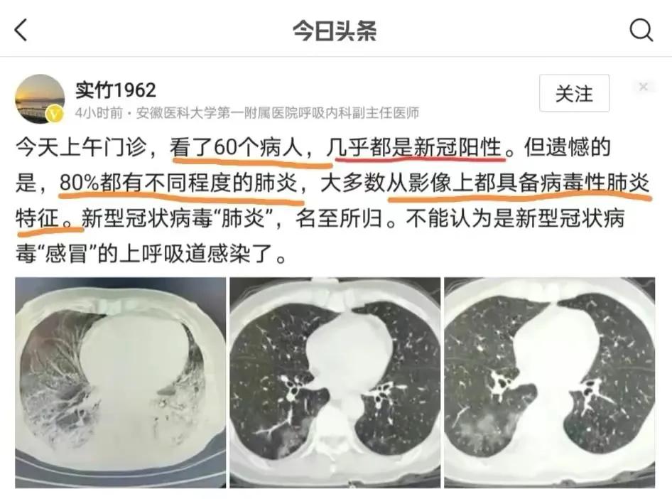 重症高峰,重症高峰过了吗