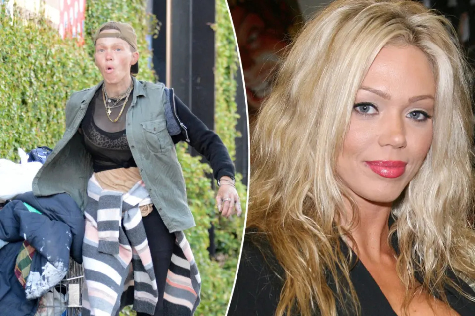 美国前名模街头捡食物，手指瘀伤眼睛红肿，染恶习无收入只能流浪