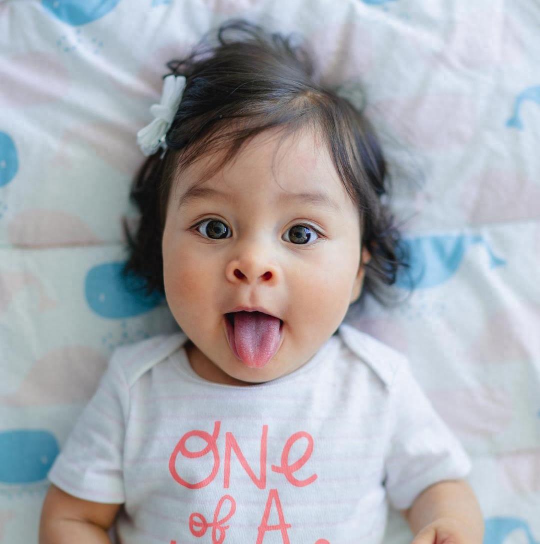 自闭症鹦鹉学舌怎么办,鹦鹉学舌都是自闭症的表现吗