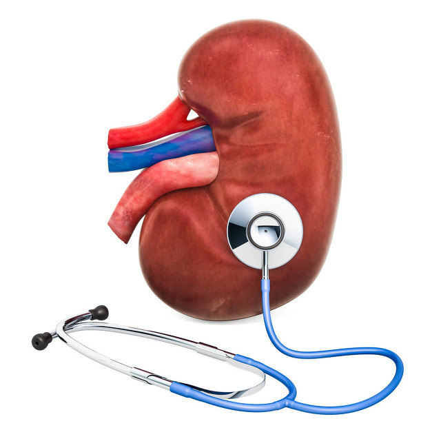 腹腔镜肾切除示意图,腹腔镜肾脏部分切除术