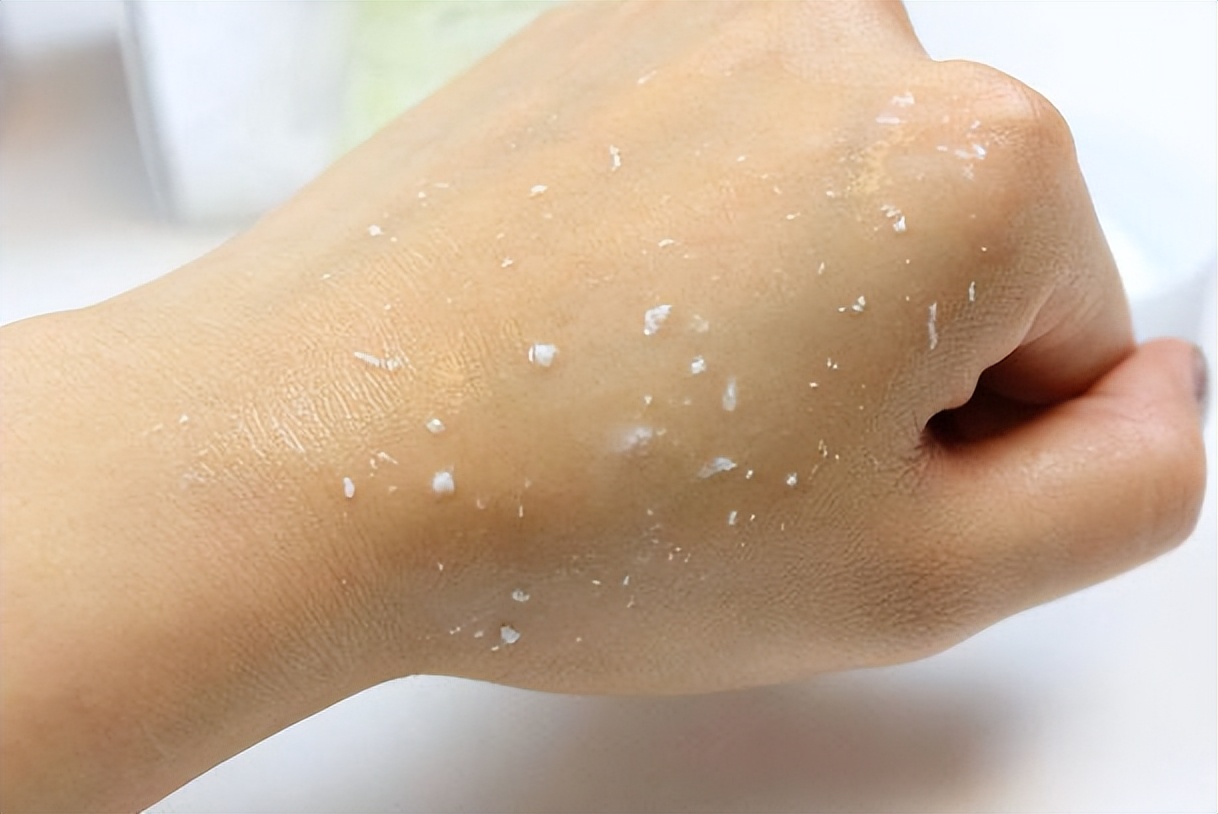 夏季：为什么有的人“一晒就黑”，有的人怎样都晒不黑？