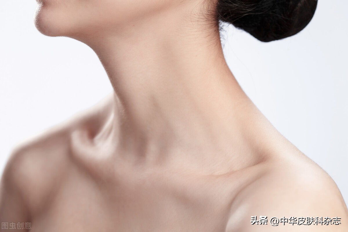 皮肤淋巴瘤遗传吗,皮肤t细胞淋巴瘤