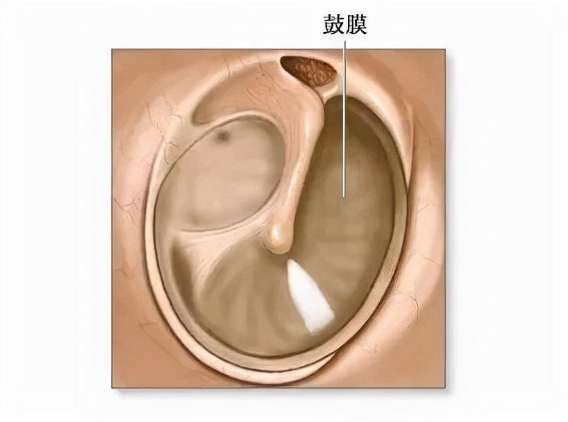 鼓膜穿孔不可以立刻做伤情鉴定吗,鼓膜穿孔有必要补吗