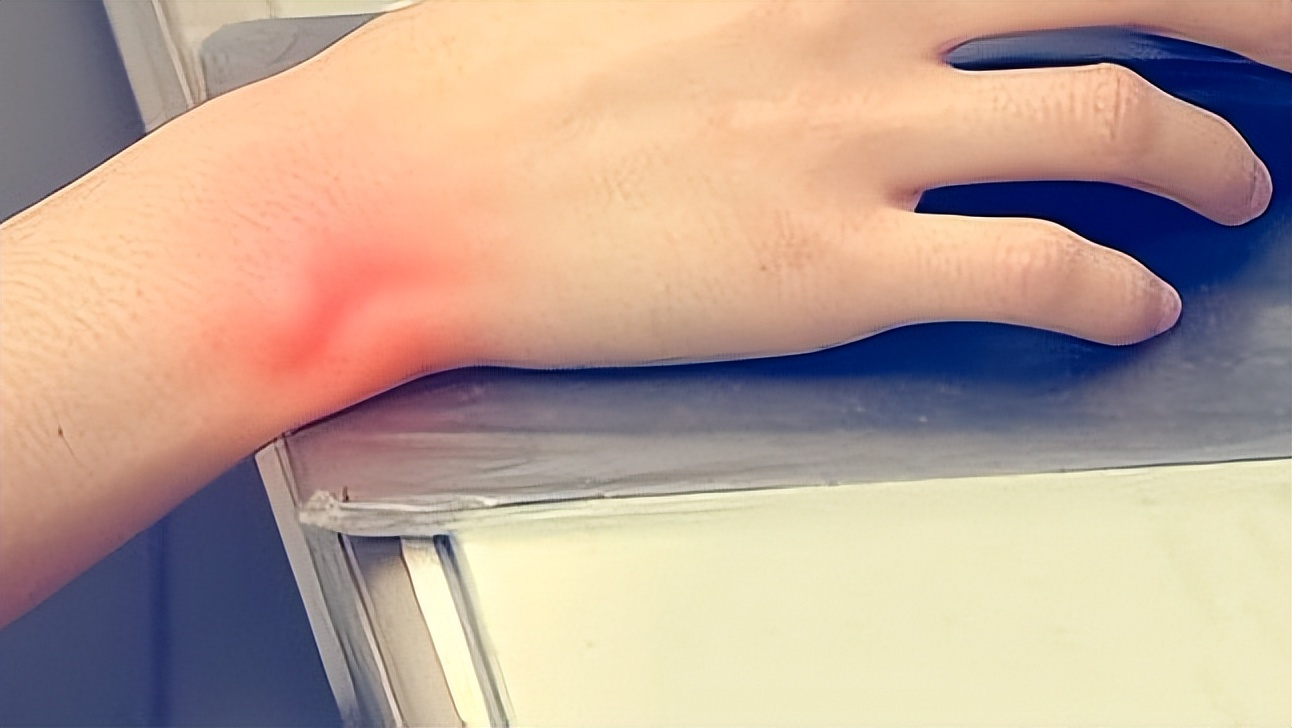 手指僵硬发胀怎么回事,手指僵硬不是风湿是怎么回事