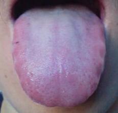 月经不调用哪种逍遥丸,逍遥散为什么是妇科调经的常用方