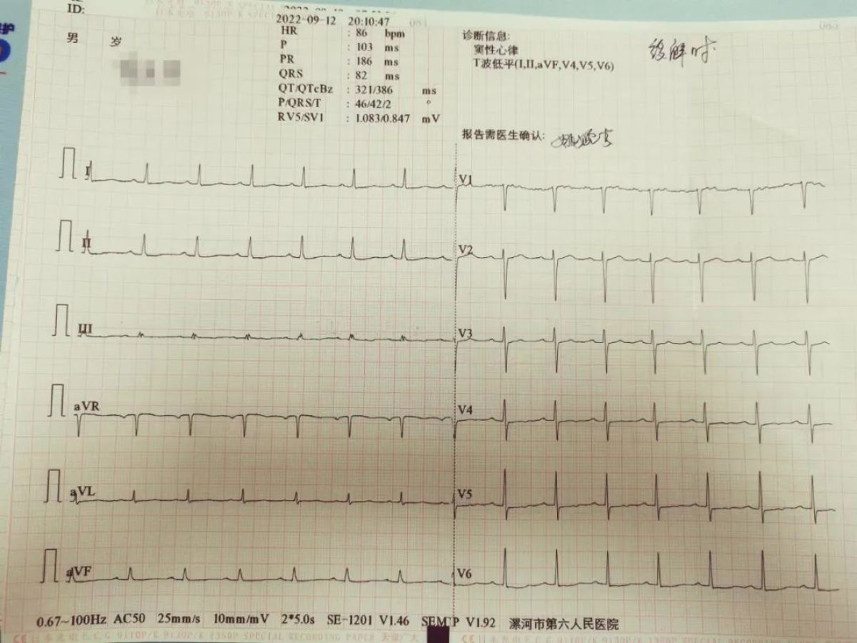 紧张心绞痛怎么缓解,不稳定型心绞痛西医治疗
