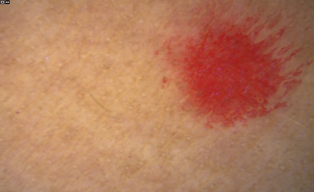 珍珠美白智商税,珍珠粉美白面霜是智商税么